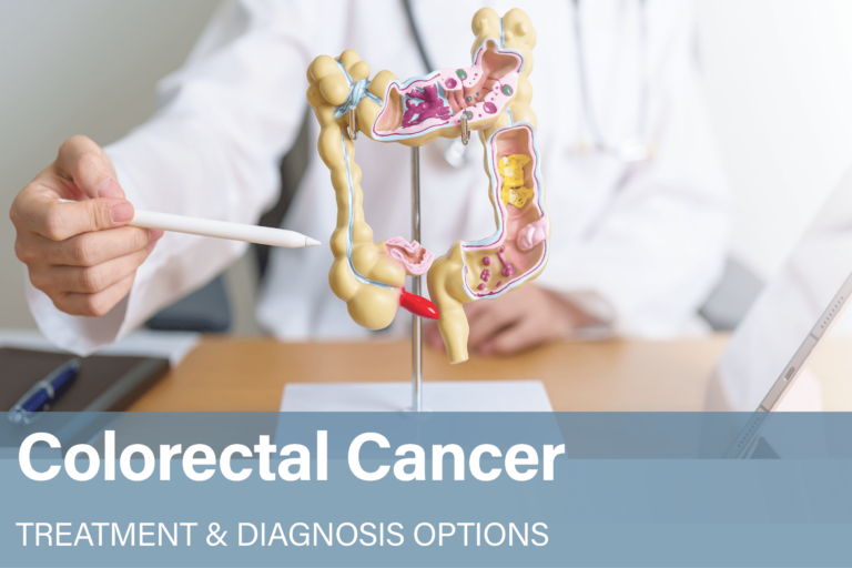 Colorectal Cancer Treatment Diagnosis Options