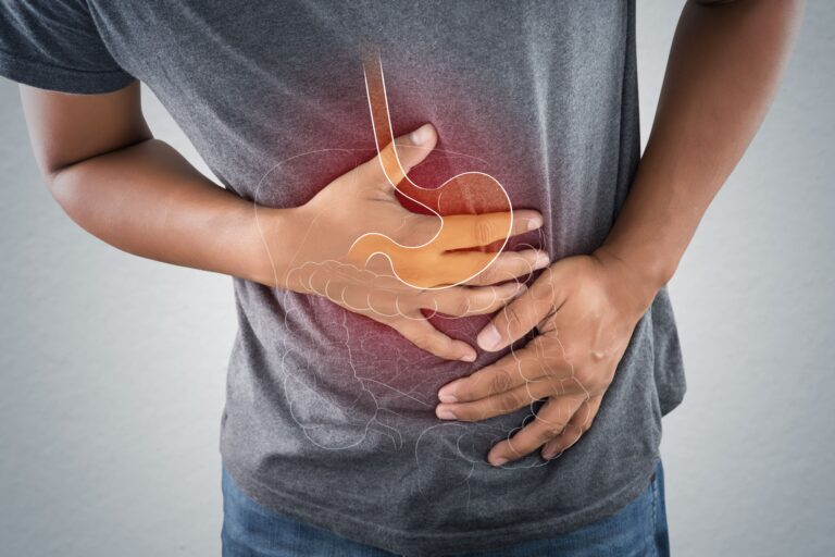 colon cancer symptoms